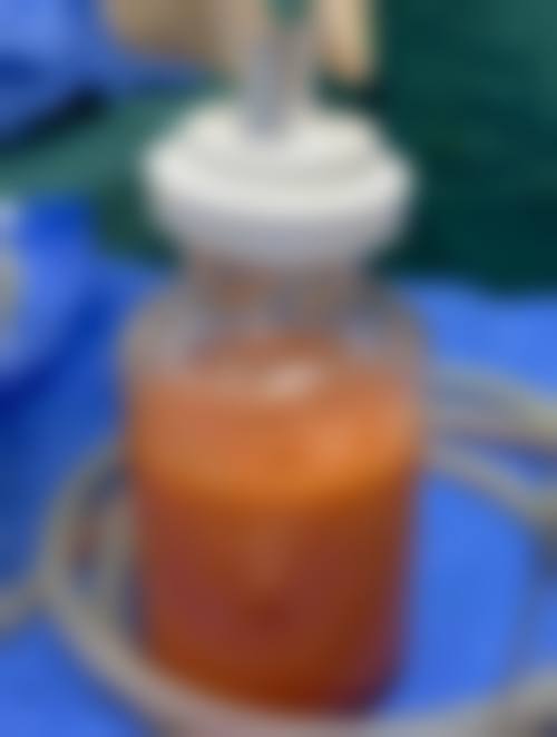 郑州郑飞医院整形科真实实例：见证美丽蜕变