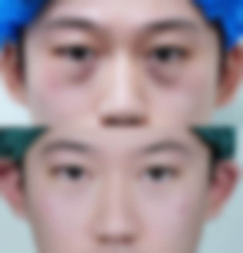 南京雅蒂娜医疗美容门诊价格表