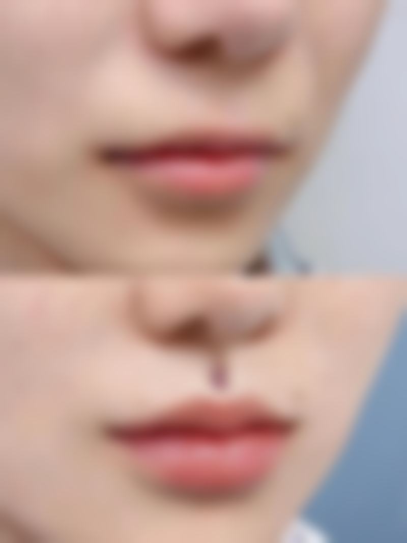 上海市闵行区中医医院皮肤美容科预约挂号方式