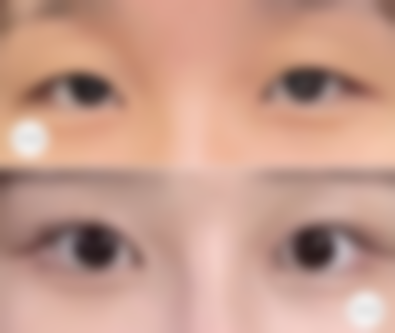 昆明莱森植发地址及乘车路线：轻松到达不迷路