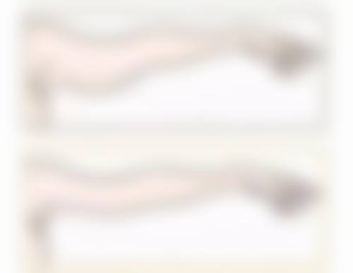 成都军建医院消除手术疤痕怎么样？