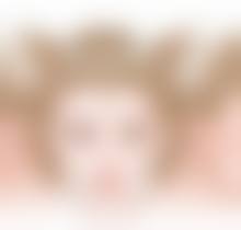 北京画美医疗美容割双眼皮会不会有后遗症，适合我吗？