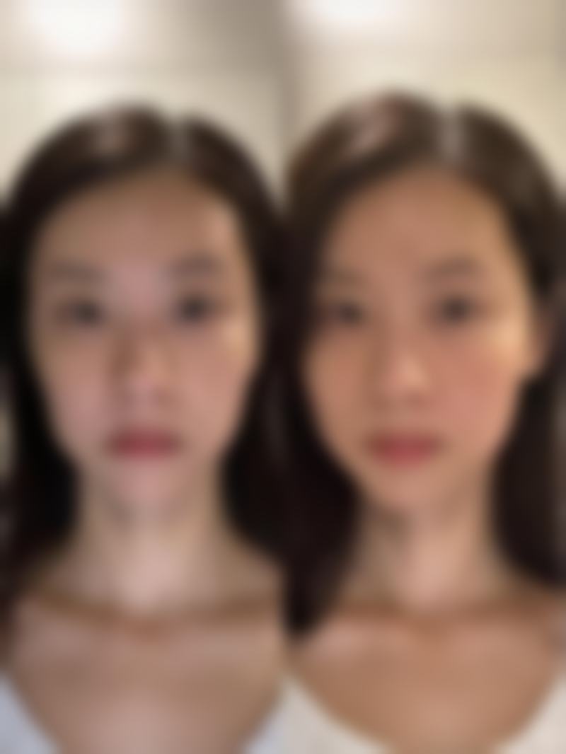 北京加减美医疗美容改善女人眼袋值不值？