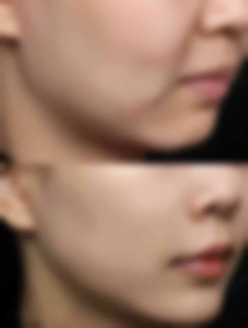 昆山陈医生整形医疗美容诊所的仪器设备精良吗?