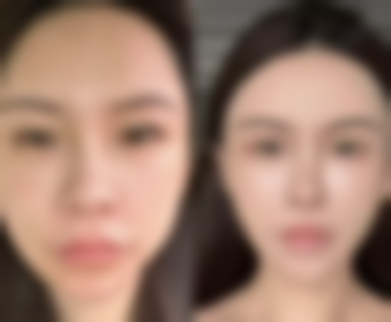 YOU&I皮肤医院仪器设备：精良科技铸就出色