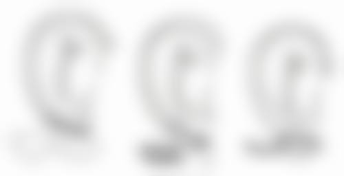 沈阳杏林整形外科医院快速消除眼袋靠谱吗？