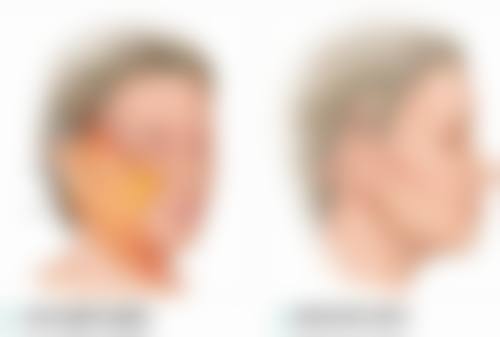 森本亚玲看诊优势