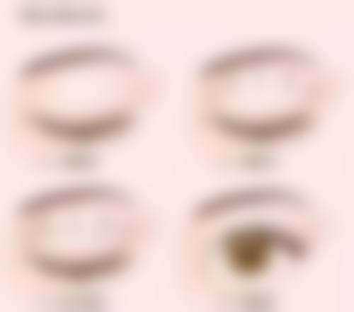 福清东南眼科医院在疤痕增生黑色素沉淀治疗上值不值选择？