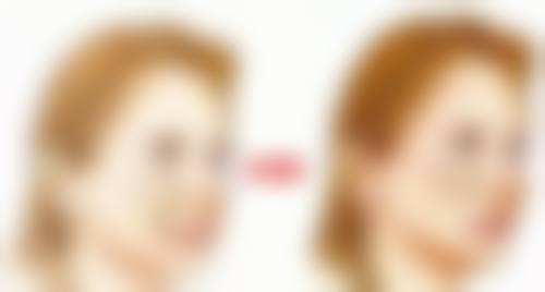 北京画美医疗美容隆胸后母乳喂养值不值？