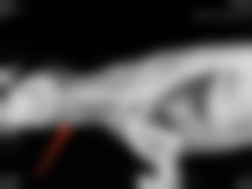 韩国安成烈整形外科价格表：透明合理性价比高