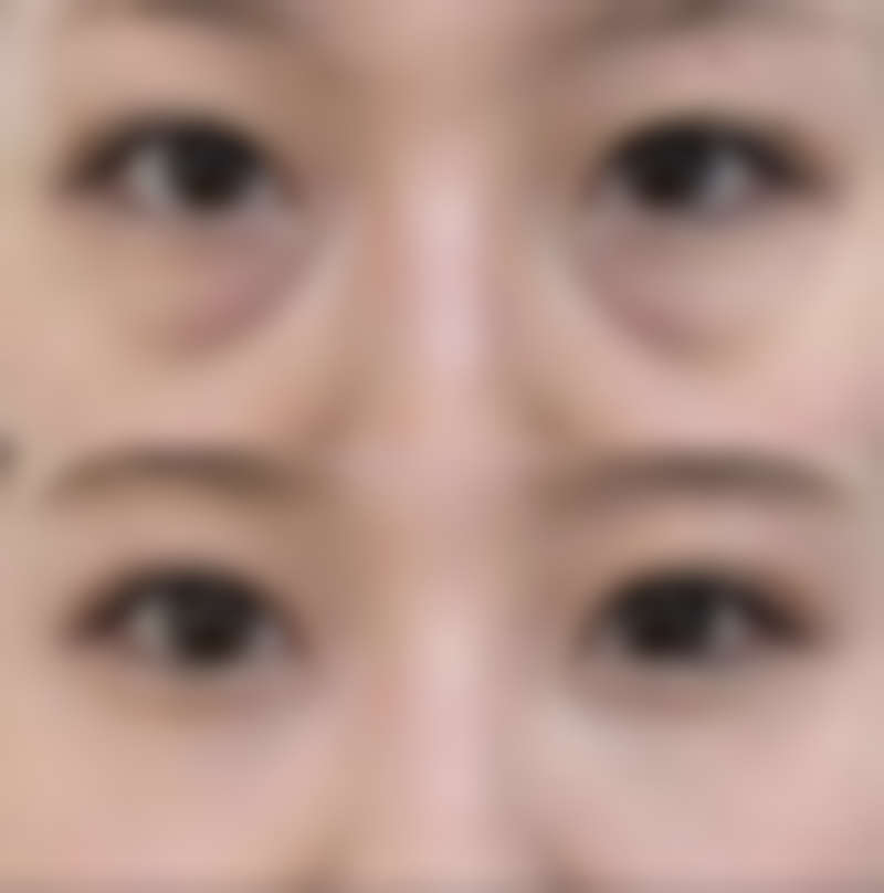 割双眼皮哪个季节割比较好？揭秘四季割双眼皮的优势与注意事项，让你美眼无忧，轻松变美！ 