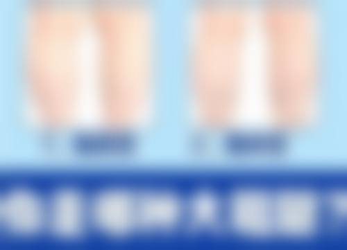 北京加减美医疗美容治疗疤痕疙瘩硬适合吗？