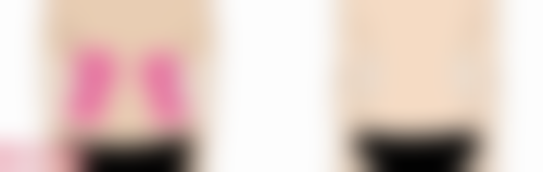 北京京韩医疗美容月经完毕多久打瘦脸针适合吗？