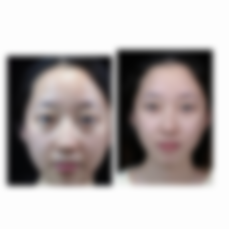 东莞南城健瑞韩美整形医疗美容门诊部擅长项目