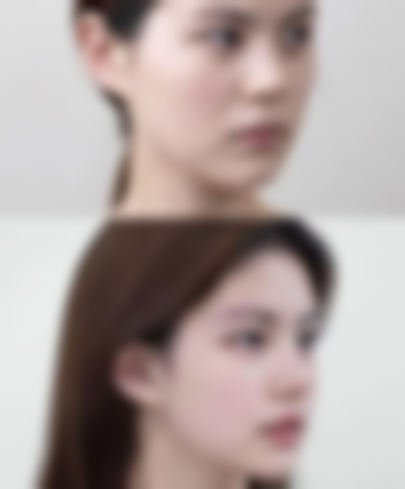 植眉修复眉毛疤痕适合所有人吗？