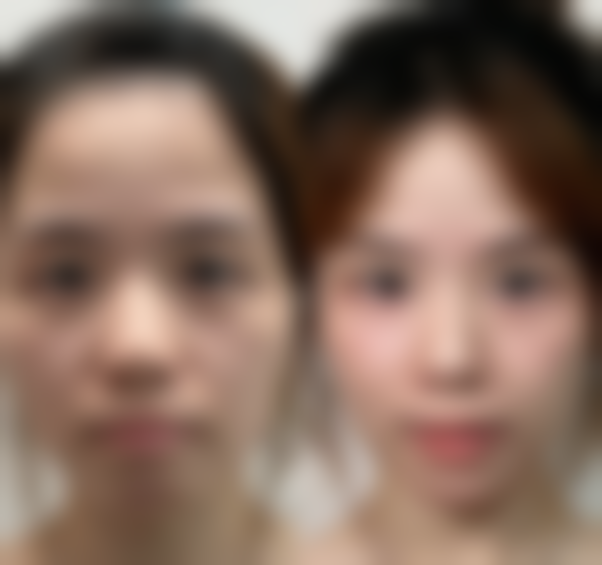 郑州惠美整形医疗美容门诊部口碑怎么样：美丽见证顾客心声