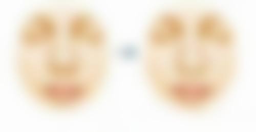 福清东南眼科医院去除眼袋和黑眼圈值不值