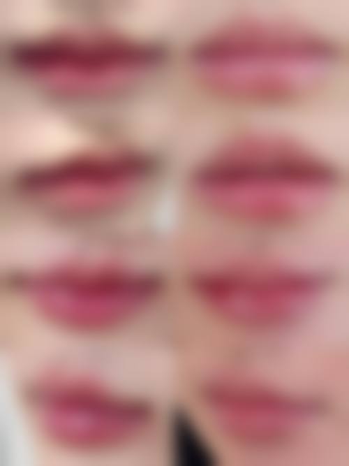 金堂正念正美整形医院真实实例:实力见证美丽奇迹