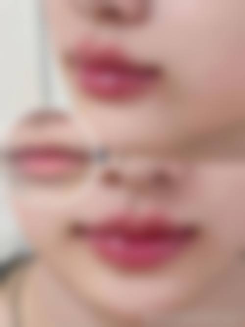 郑州美葩整形医院口碑怎么样:顾客真实评价见证实力