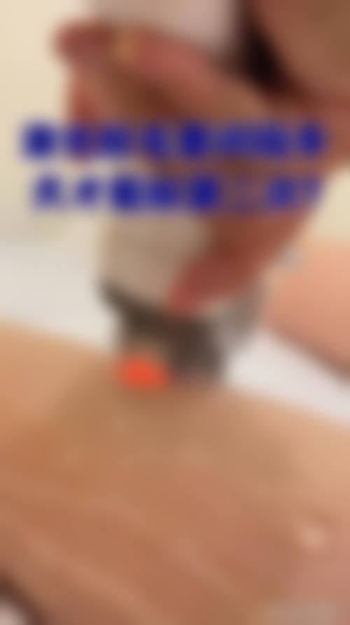 深圳爱氏医疗美容门诊部真实实例