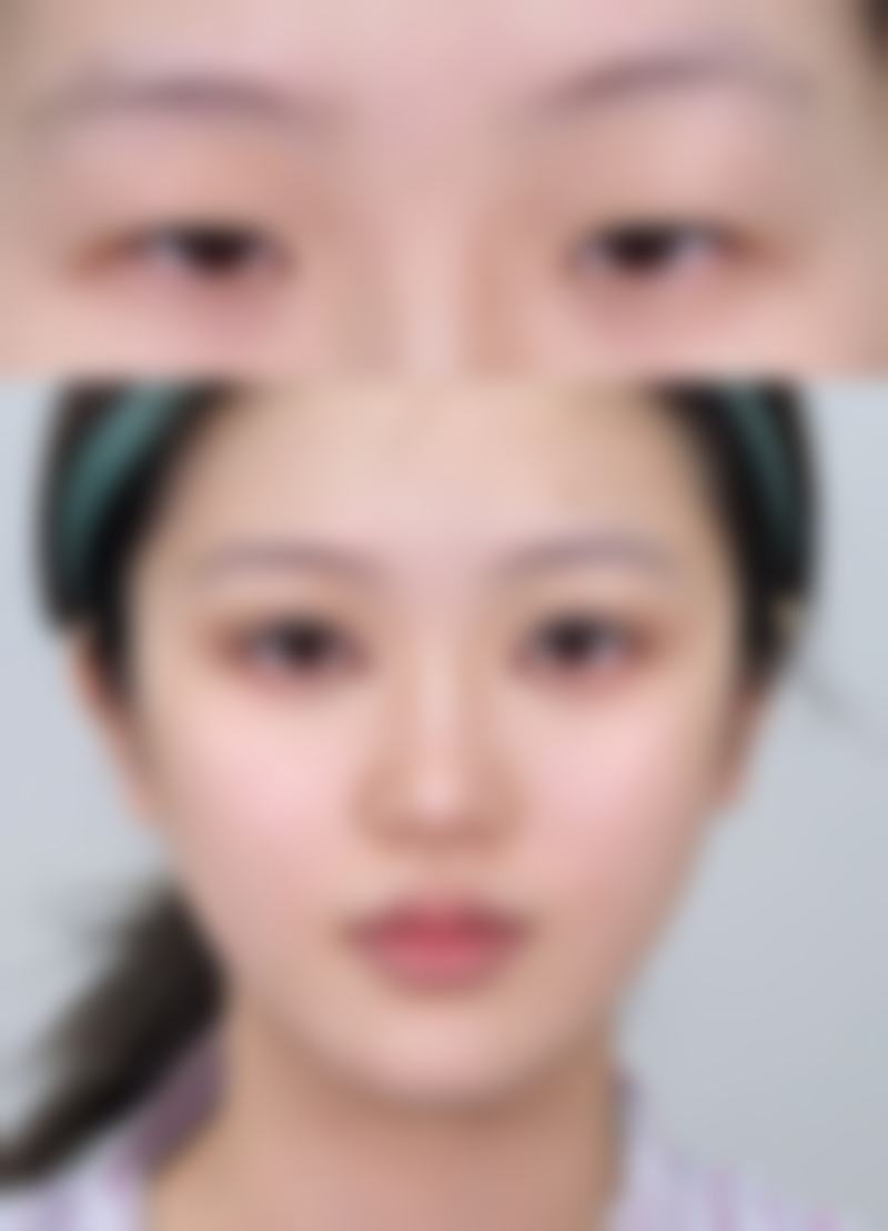 隆胸以后生孩子可以喂奶吗？揭秘权威医学观点与3大关键因素，让你清楚知晓隆胸妈妈哺乳的真相！ 