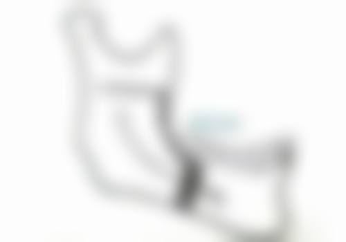 武汉华美整形医院（口腔科）真实实例