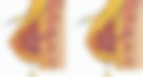 福清东南眼科医院去除下眼袋脂肪粒值不值