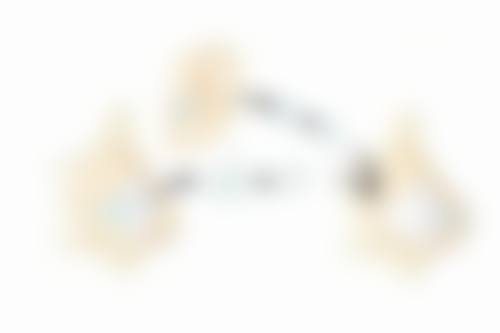 三点定位双眼皮的修复过程是怎样的？