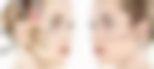 北京圣嘉新医疗美容医院割双眼皮，能否助力女生实现变得更美愿景？