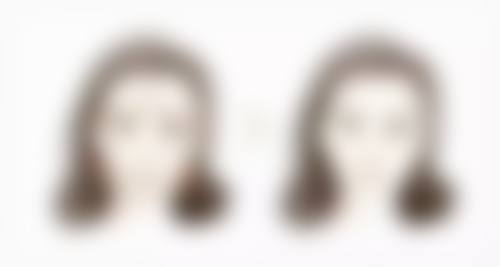 黄瓜贴眼袋有效果吗？医美专家揭秘：90%的人不知的黄瓜去眼袋小妙招，真的超有效！ 