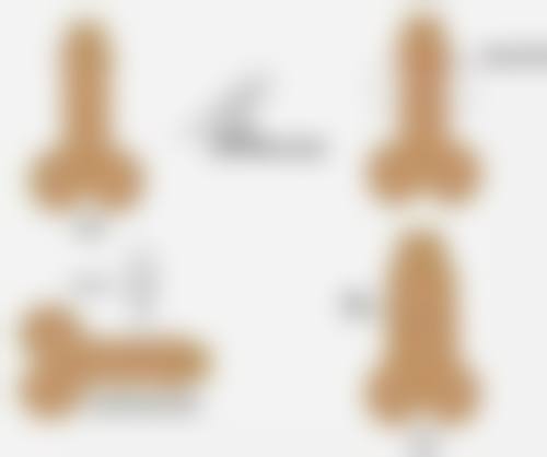 韩国 JN 整形医院打针隆鼻用什么材料值不值？