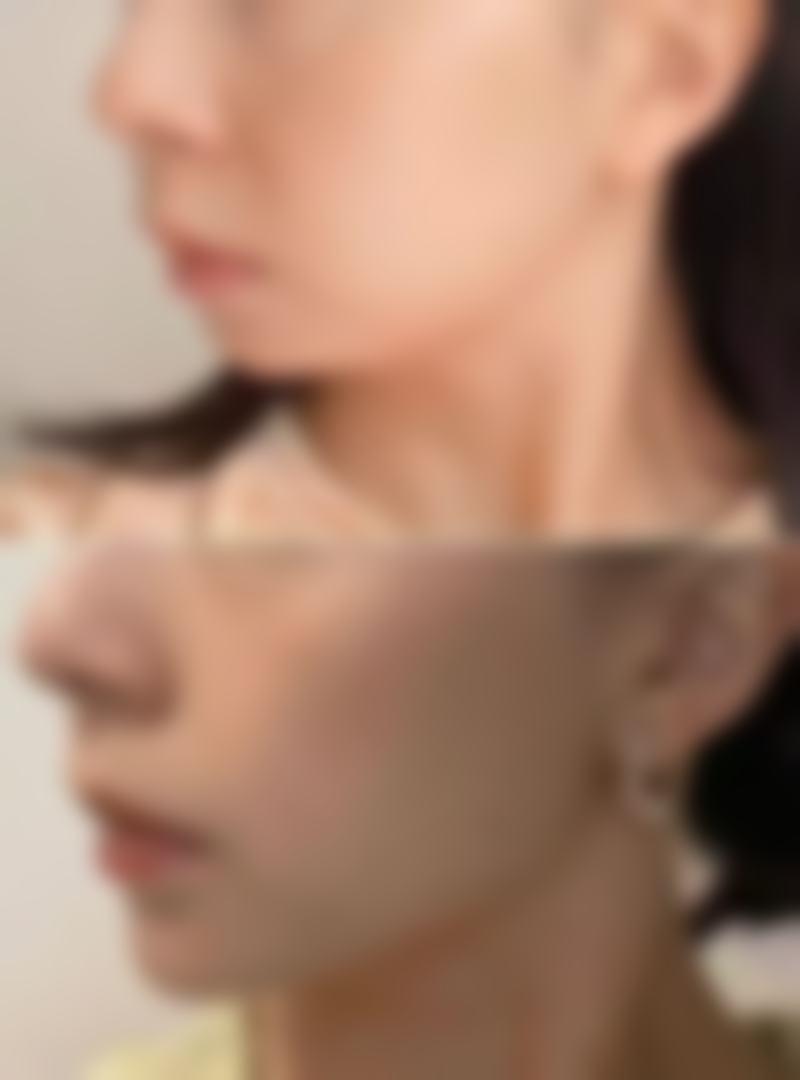 宜宾天一医疗美容诊所真实实例：见证美丽奇迹