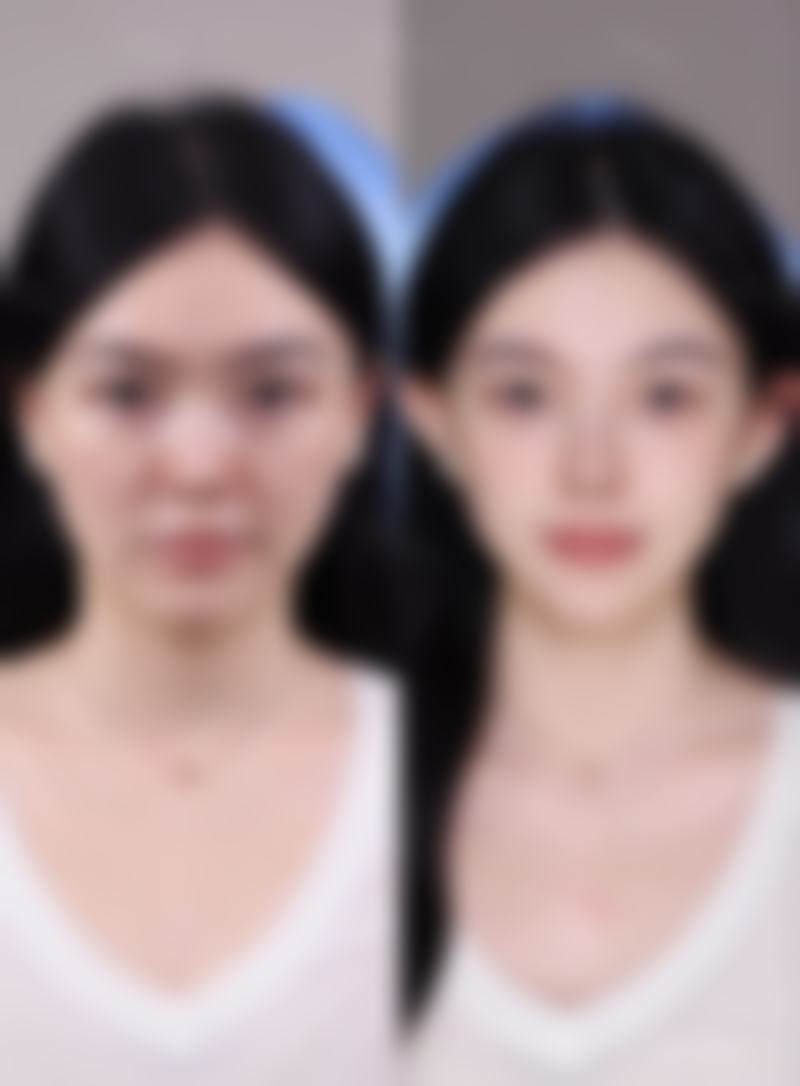 张淑珍医生技术特点