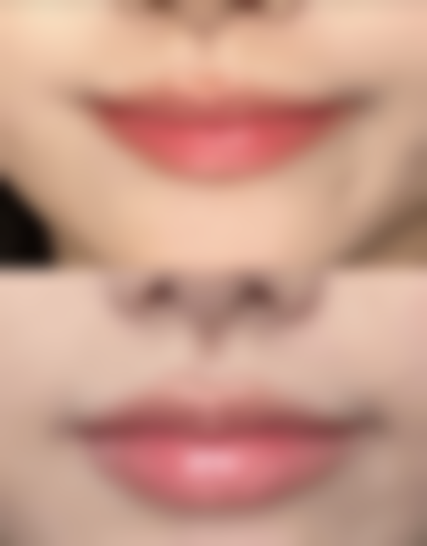 何氏眼科补充胶原蛋白对去眼袋有帮助吗