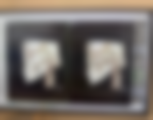 沈阳杏林整形补充胶原蛋白去眼袋适合吗