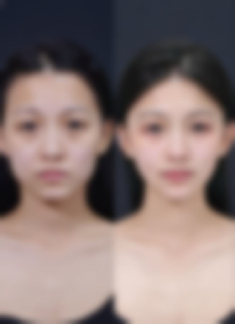 临沂东方医疗美容诊所擅长项目:打造专属美丽方案