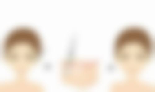 怎么可以臀部抽脂？揭秘3种有效途径，了解术后恢复要点，让你安全拥有翘臀不是梦！ 