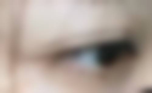 北京嘉禾医疗美容做双眼皮让眼睛变大成效怎么样？