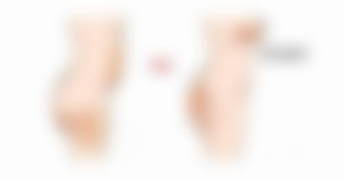 北京丽合医疗美容去除凹陷疤痕靠谱吗