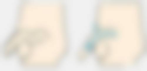 杭州艺星皮肤美容做臀部抽脂怎么样？