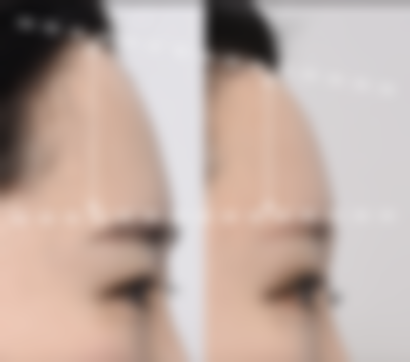 周丽媛医生真实实例:见证美丽的奇迹