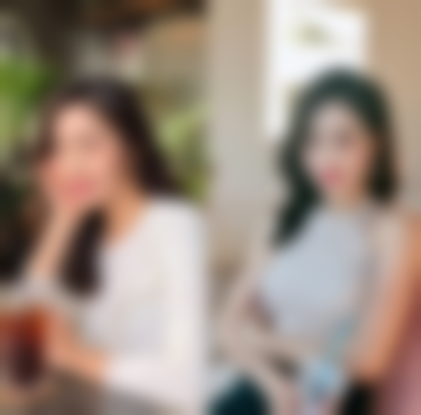 呼和浩特京美医疗美容医院割双眼皮后遗症怎么样