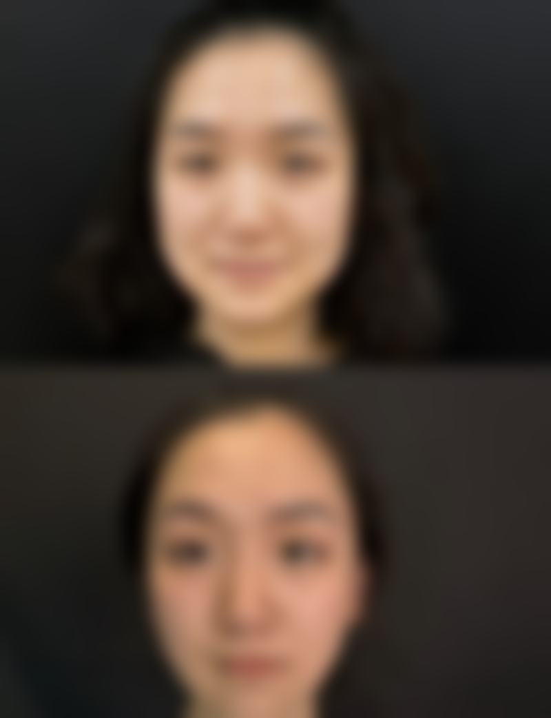 李雅江医生技术特点