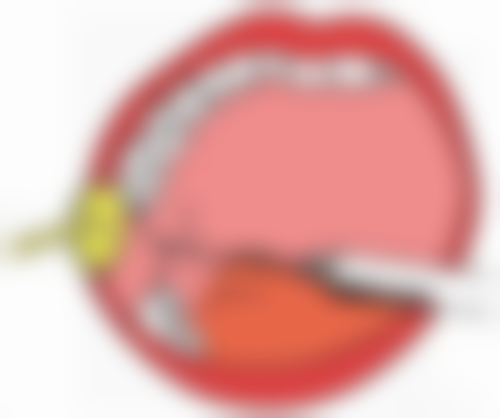 沈阳杏林整形的眼膜搭配手术去黑眼圈眼袋适合吗?