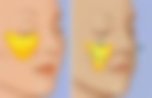 北京加减美医疗美容做阴道紧缩手术适合吗？