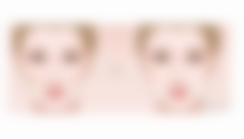 成都素美使用眼膜去黑眼圈眼袋靠谱吗?