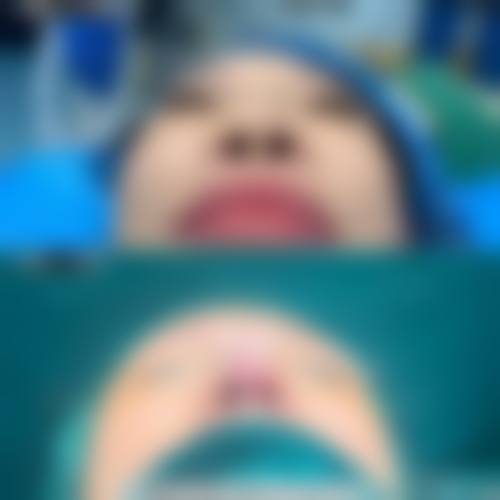 东莞伊嘉整形医院价格表