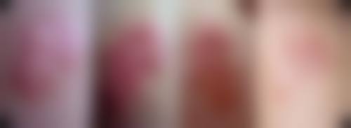 百色贞韩医疗美容诊所(贞韩植发医院)价格表