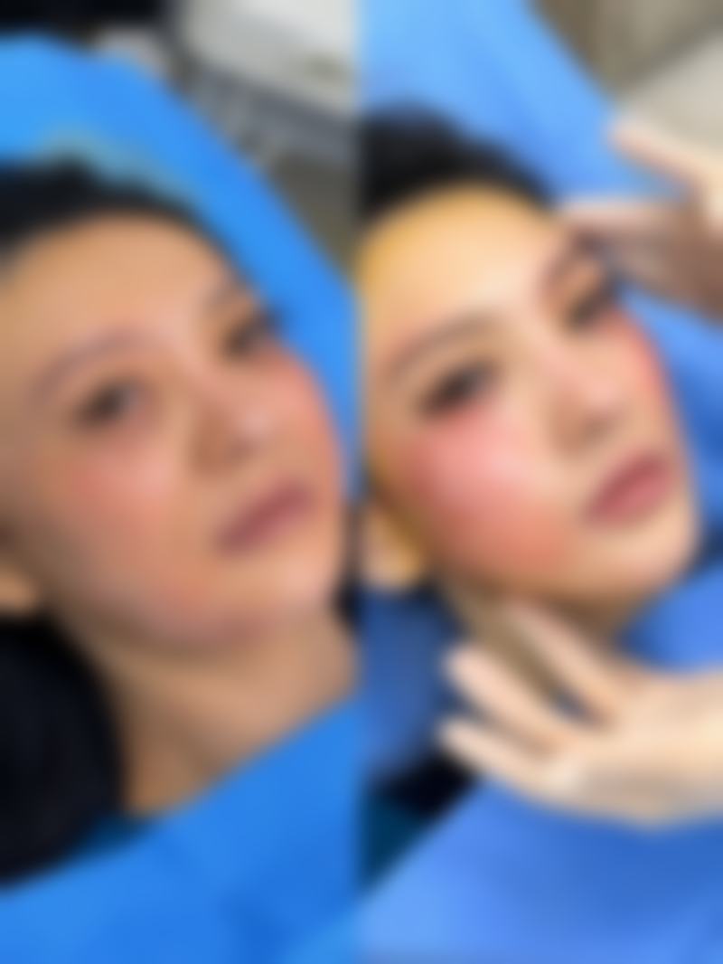 打完瘦脸针后去北京京韩医疗美容进行修复指导靠谱吗？