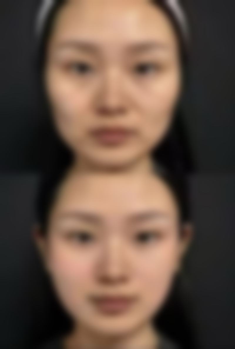 打完瘦脸针后去北京禾美嘉医疗美容复查靠谱吗？